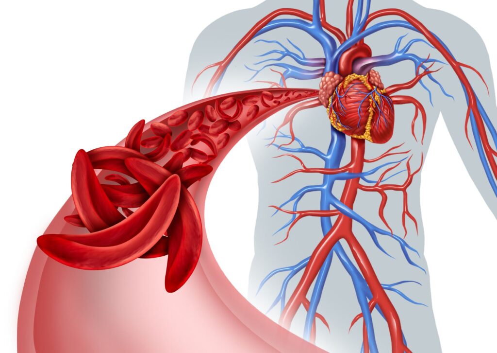 Blood flow circulation