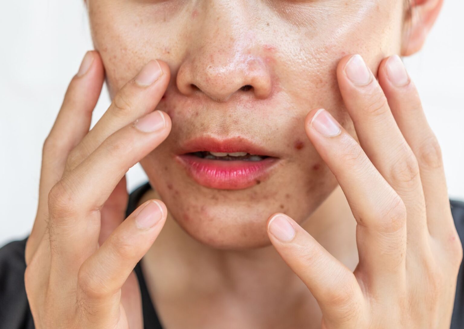 Exploring the Skin and Hair Benefits of Cold Showers Loving Life